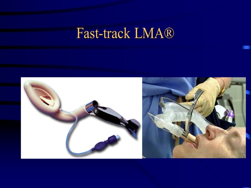 Fast-track LMA®